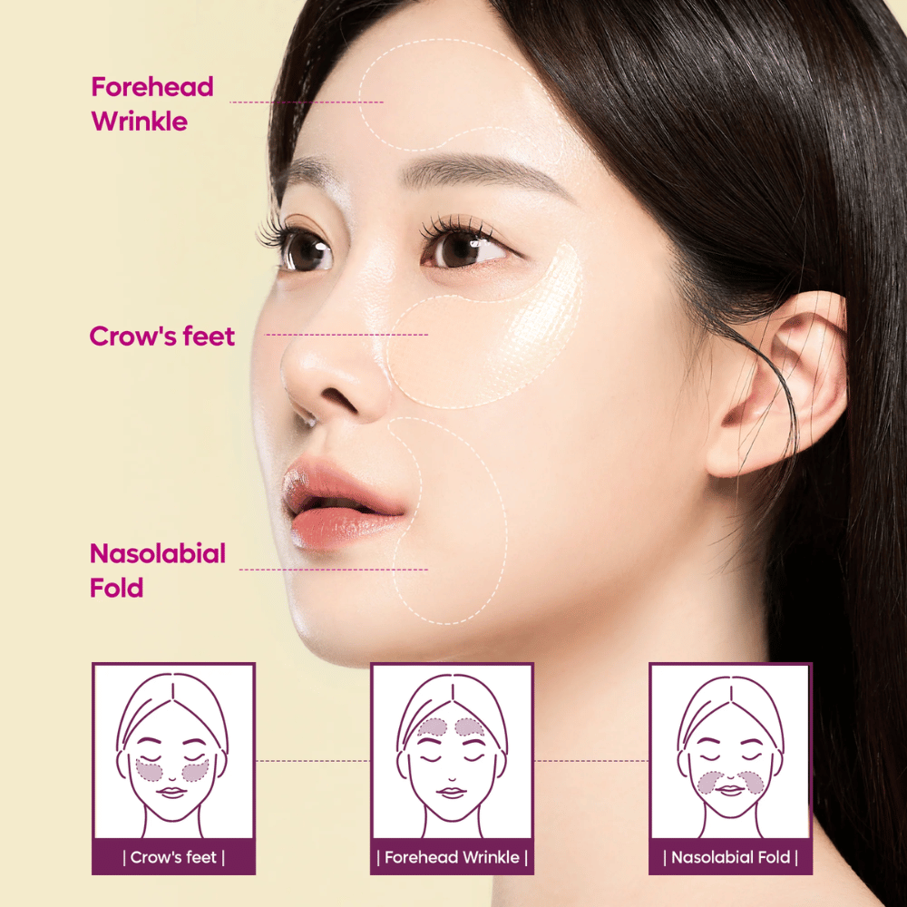 Model met oogpatches geplaatst bij kraaienpootjes, voorhoofd en nasolabiale lijnen die laten zien hoe Dr. Melaxin Cemenrete Calcium Volume Eye Patch kan worden gebruikt voor rimpels en volumeverlies.