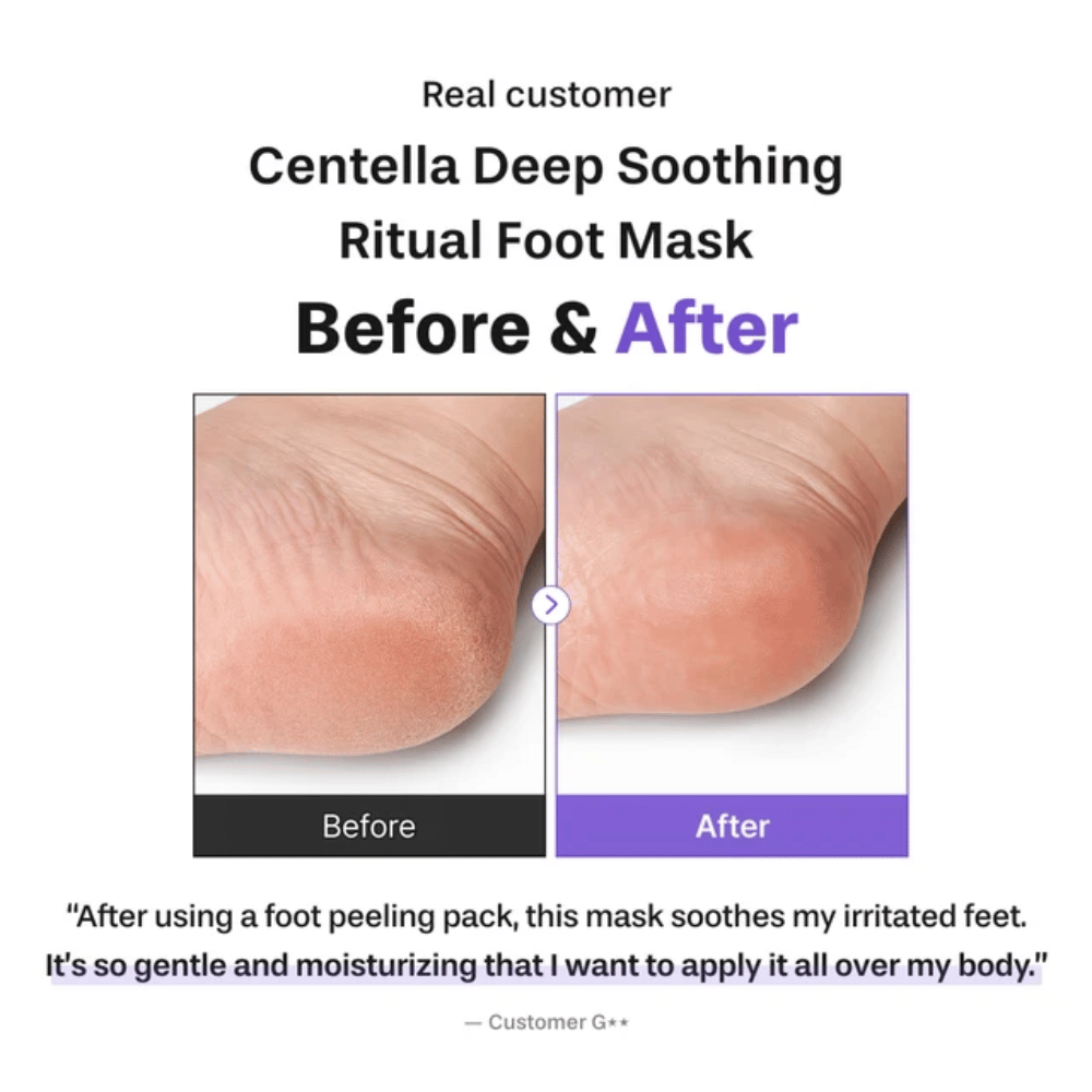 6. Baren Centella Deep Soothing Ritual Foot Mask – voor- en nafoto die een zachtere en meer gehydrateerde hiel na gebruik laat zien