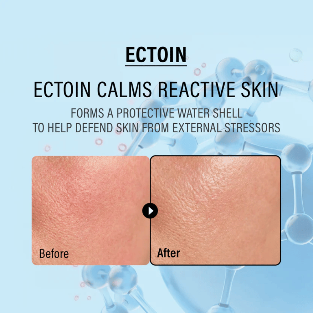 EPII Double Up Cream met ectoïne die de gevoelige huid kalmeert, beschermt tegen externe invloeden en de natuurlijke barrière van de huid versterkt.