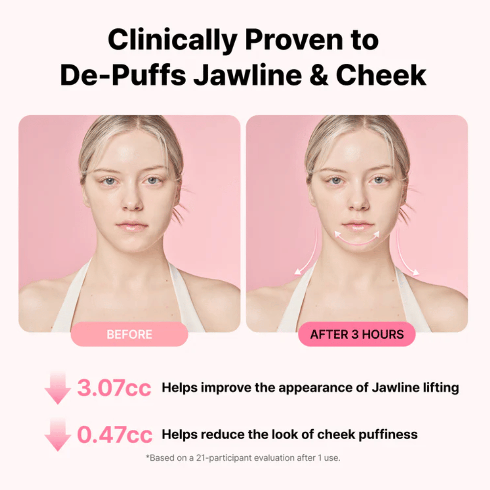 Voor- en nafoto die een verbeterd uiterlijk van de kaaklijn en verminderde zwelling illustreert na gebruik van RETURNITY Ear Therapy Acupressure Patch gedurende drie uur.