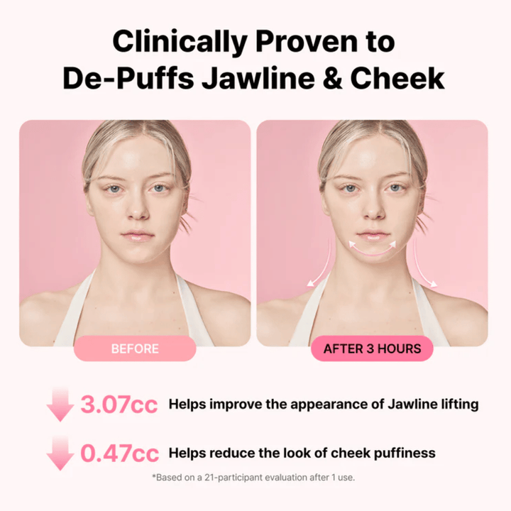 Voor- en nafoto die een verbeterd uiterlijk van de kaaklijn en verminderde zwelling illustreert na gebruik van RETURNITY Ear Therapy Acupressure Patch gedurende drie uur.