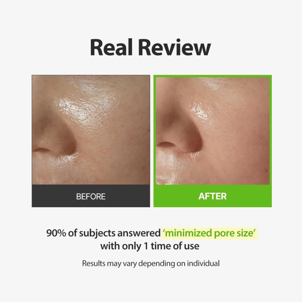 SUNGBOON EDITOR Green Tomato Pore Peeling Jumbo Pad – voor- en nafoto met focus op zichtbare poriën