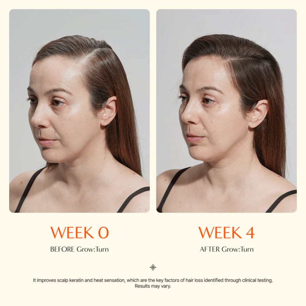 Voor- en nafoto van een vrouw (week 0 vs week 4) die verbeterde haarkwaliteit en een voller gevoel na gebruik laat zien.