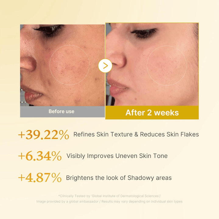 Voor- en na-afbeelding voor Medicube Kojic Acid Turmeric Resurfacing Toner die verbeterde huidtextuur, een egalere huidtoon en verminderde droge huidschilfers na twee weken gebruik laat zien.