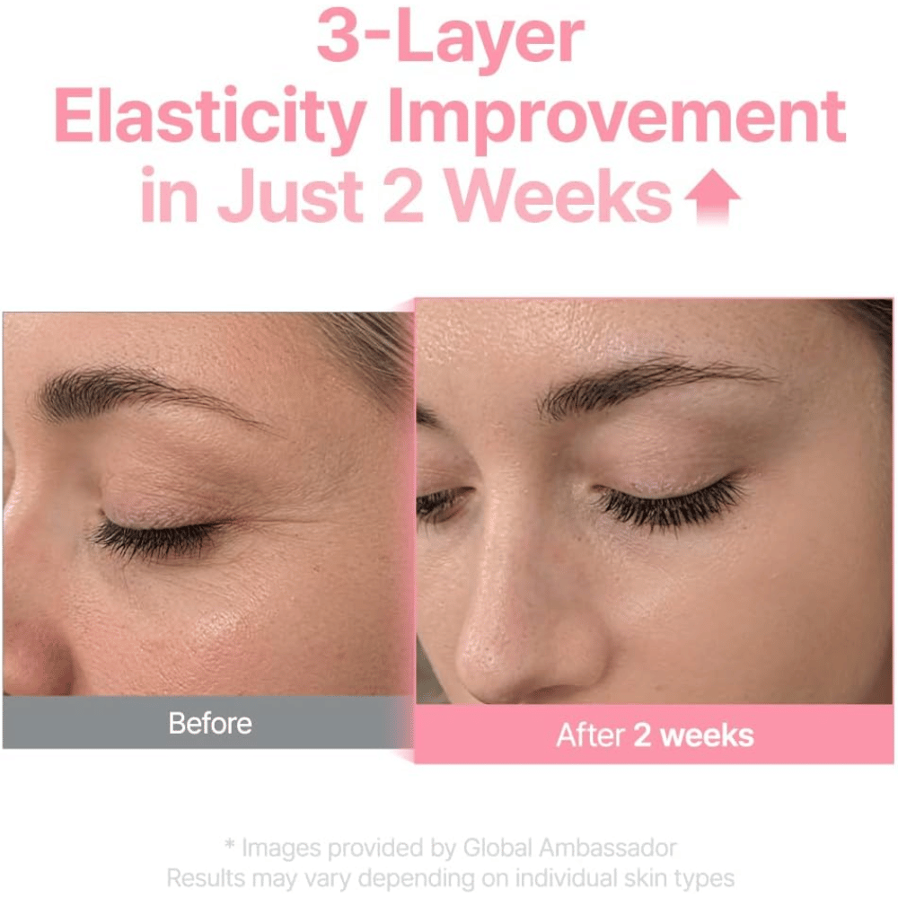 Voor- en nafoto voor Purito Multi PDRN Collagen EGF Serum die verbeterde huidelasticiteit na twee weken toont.