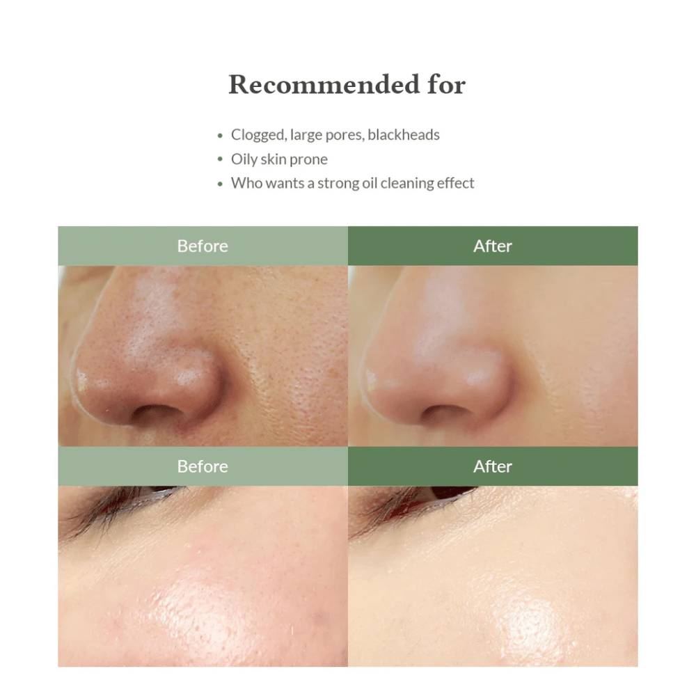 Dr. Althea Premium Quick Step Sebum Cleanser – gezichtsreiniger die helpt mee-eters te verminderen, poriën diep te reinigen en een egalere huidstructuur te geven.