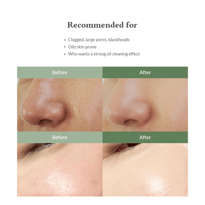 Dr. Althea Premium Quick Step Sebum Cleanser – gezichtsreiniger die helpt mee-eters te verminderen, poriën diep te reinigen en een egalere huidstructuur te geven.